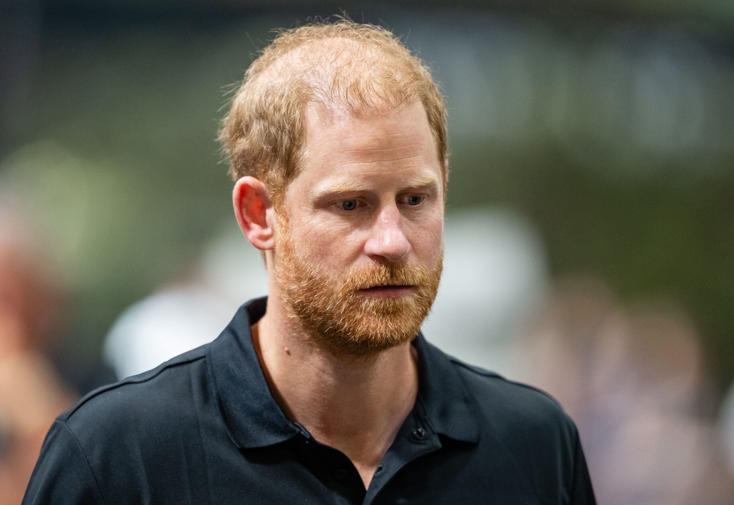 Speculation about Harry's changing hairline has circulated for years, but he has never confirmed undergoing a hair trans